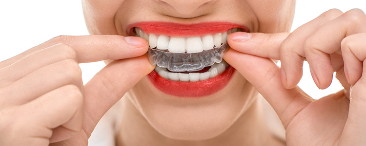 Orthodontics Treatment